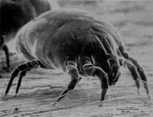 House Dust Mites love to reproduce in the summer